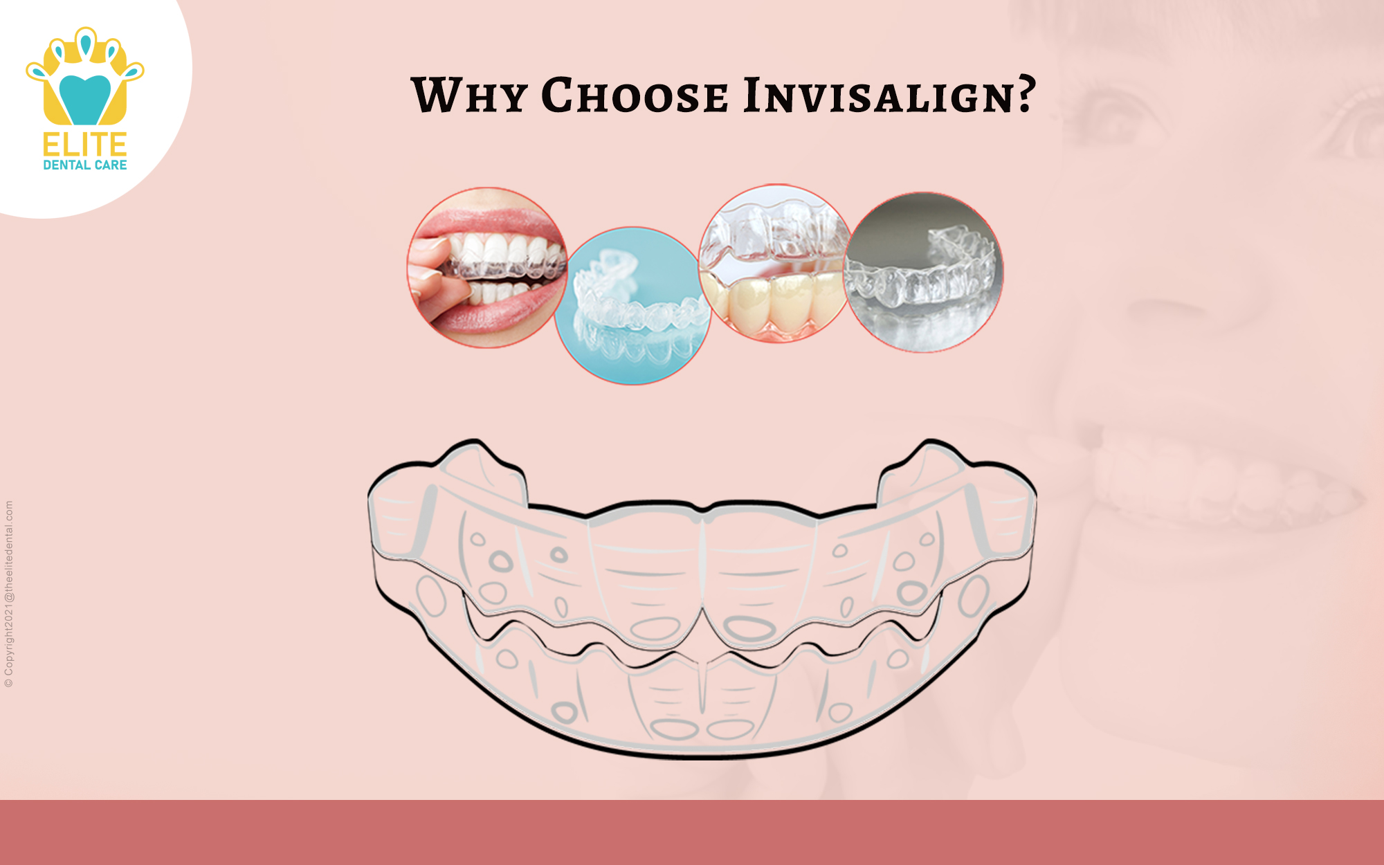 Why choose Invisalign?
