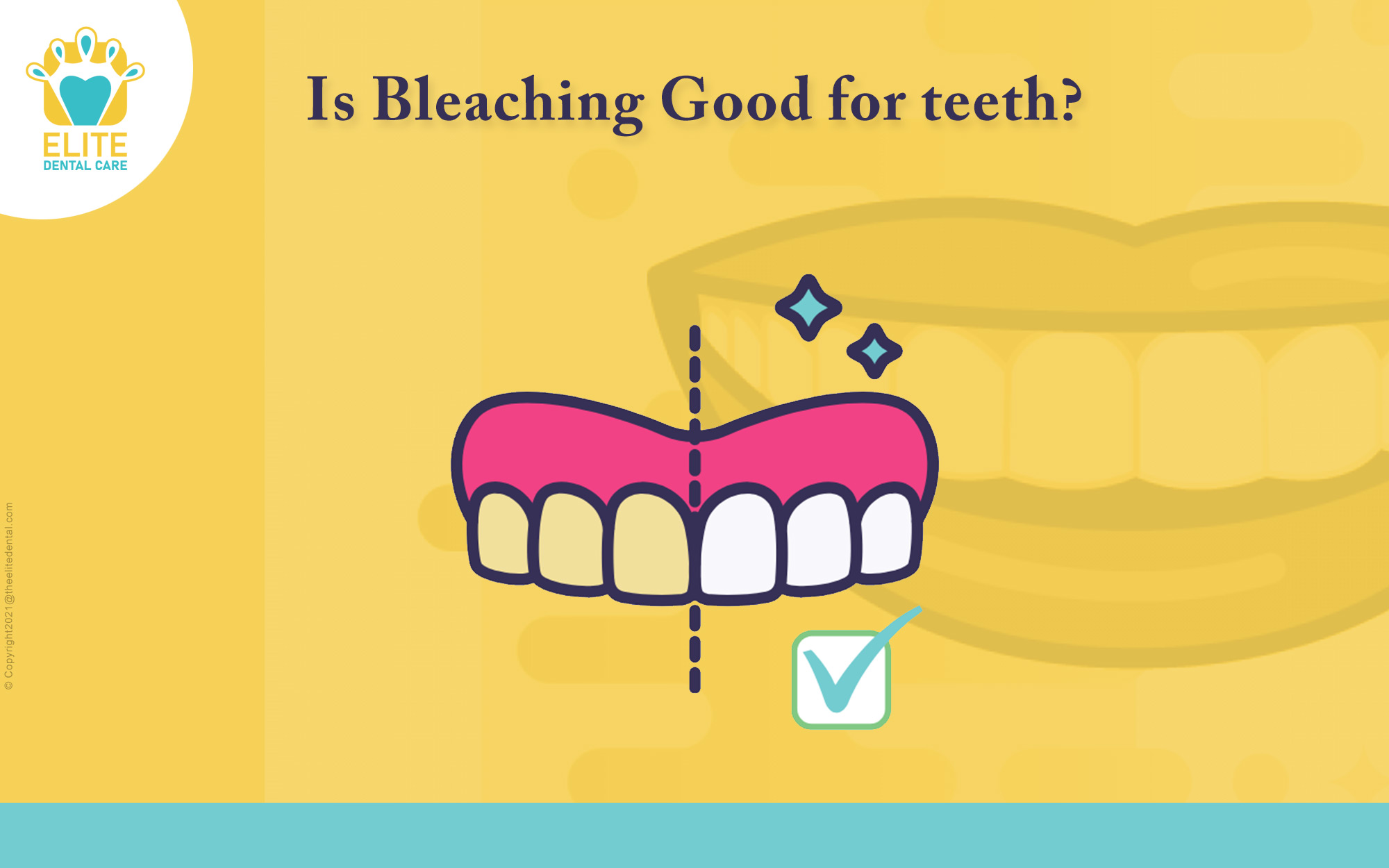 Is Bleaching Good for your Teeth?