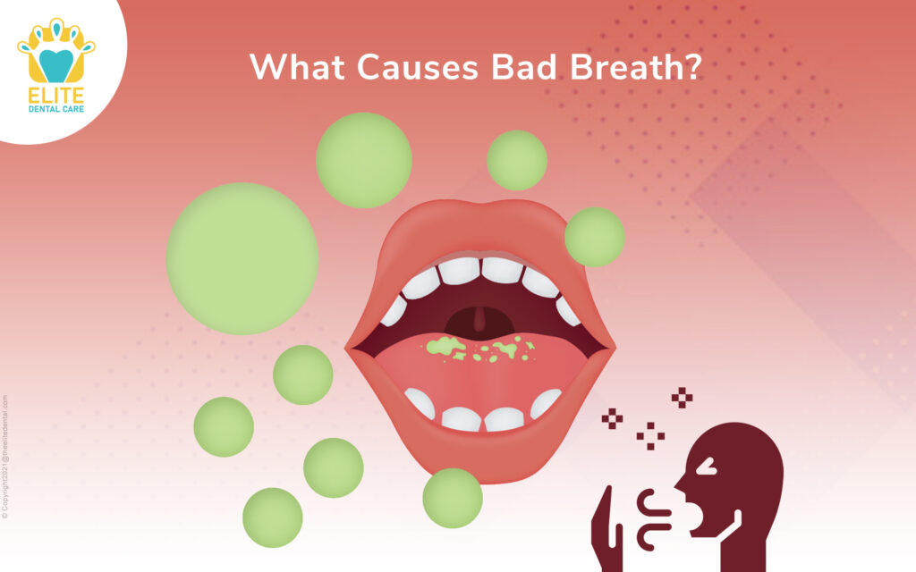 How to prevent Bad Breath? Elite Dental Care