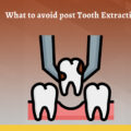 What to avoid after tooth extraction?