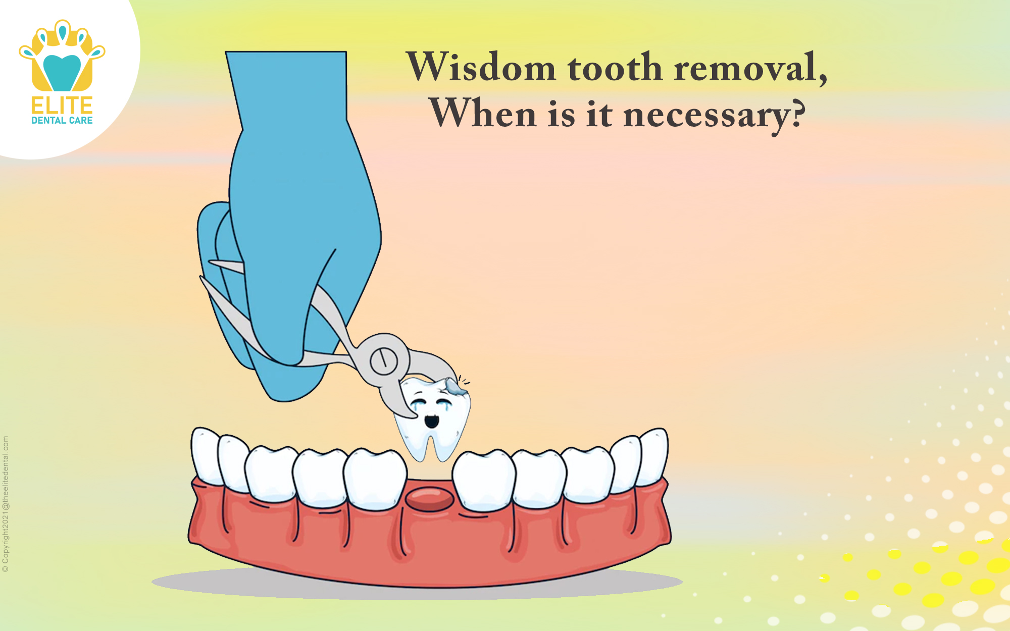 Wisdom Tooth Removal. When is it Necessary?