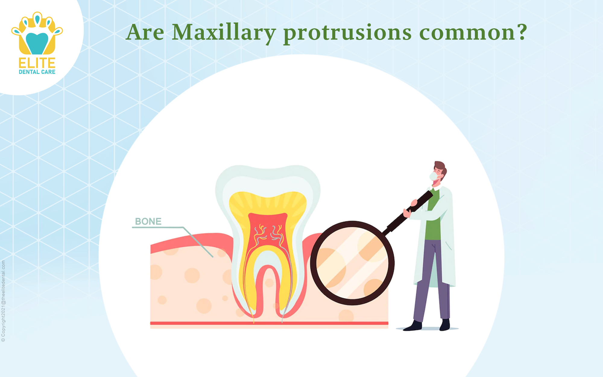 Are Maxillary Protrusions common?