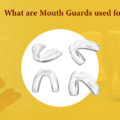 What are MouthGaurds used for?