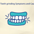 Teeth Grinding Symptoms and Causes
