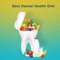 Best Dental Health Diet
