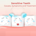 Sensitive Teeth Causes, Symptoms, and Treatments