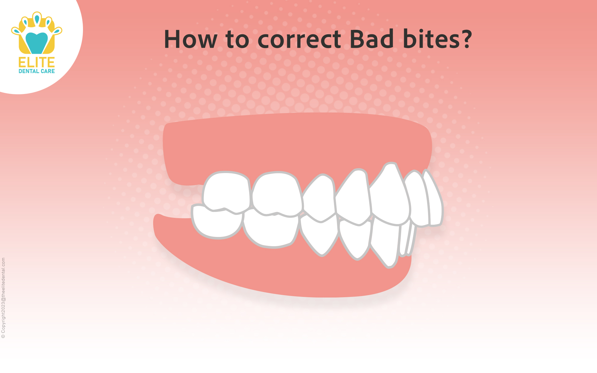 How to correct bad bites?