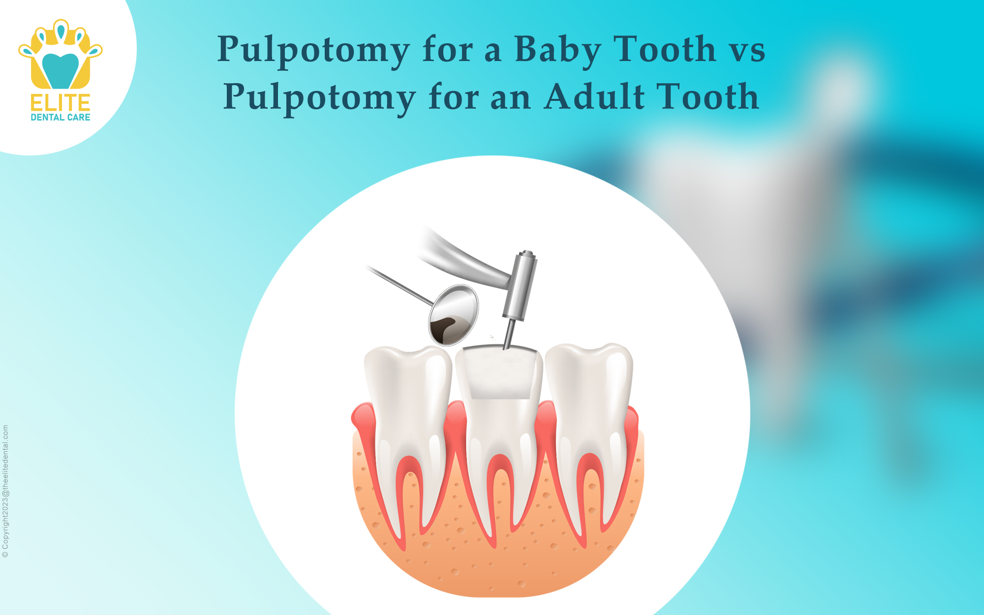 Pulpotomy for a baby tooth vs Pulpotomy for an adult tooth