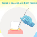 WHAT IS SCALING AND ROOT PLANING?