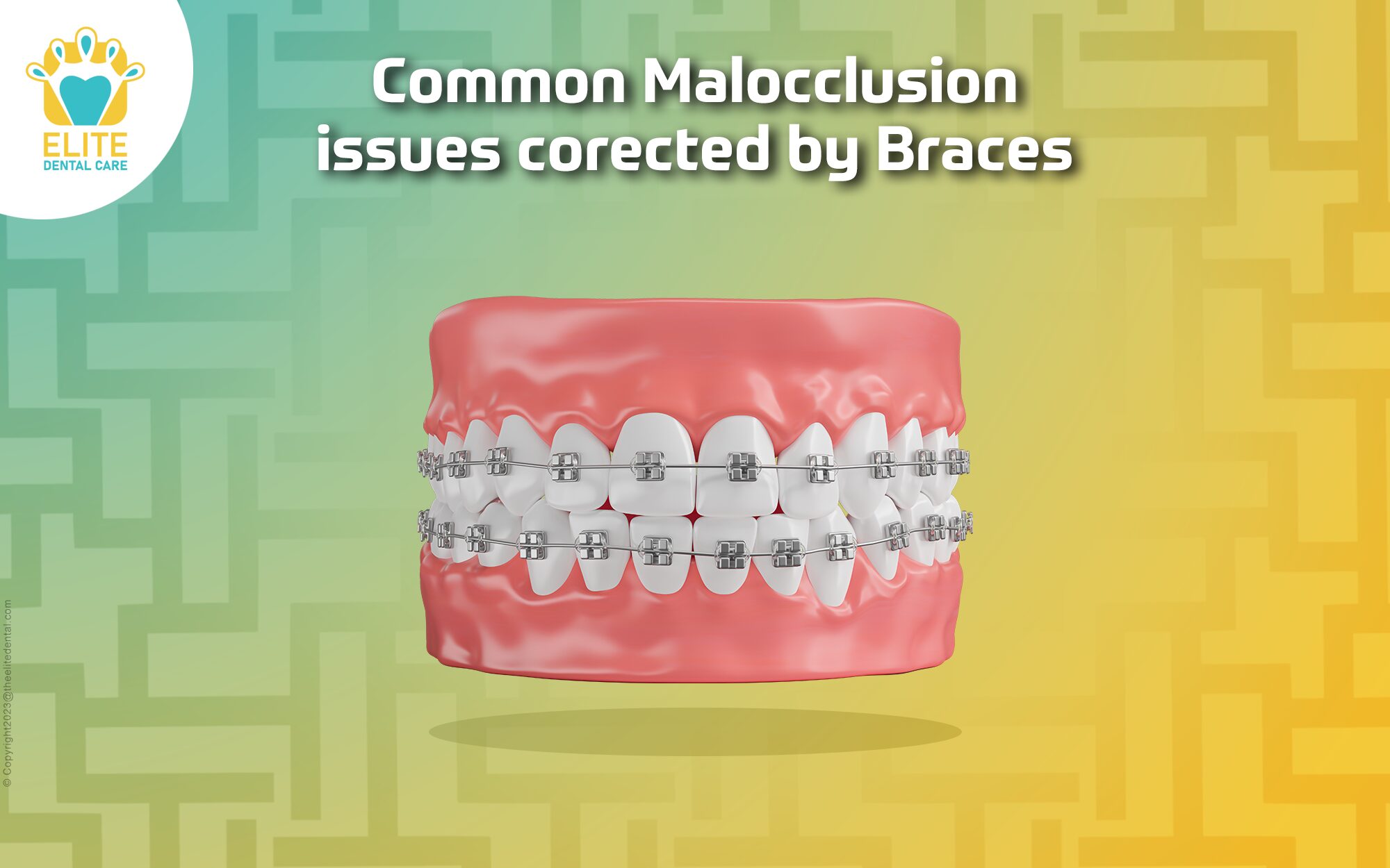 COMMON MALOCCLUSION ISSUES CORRECTED BY BRACES