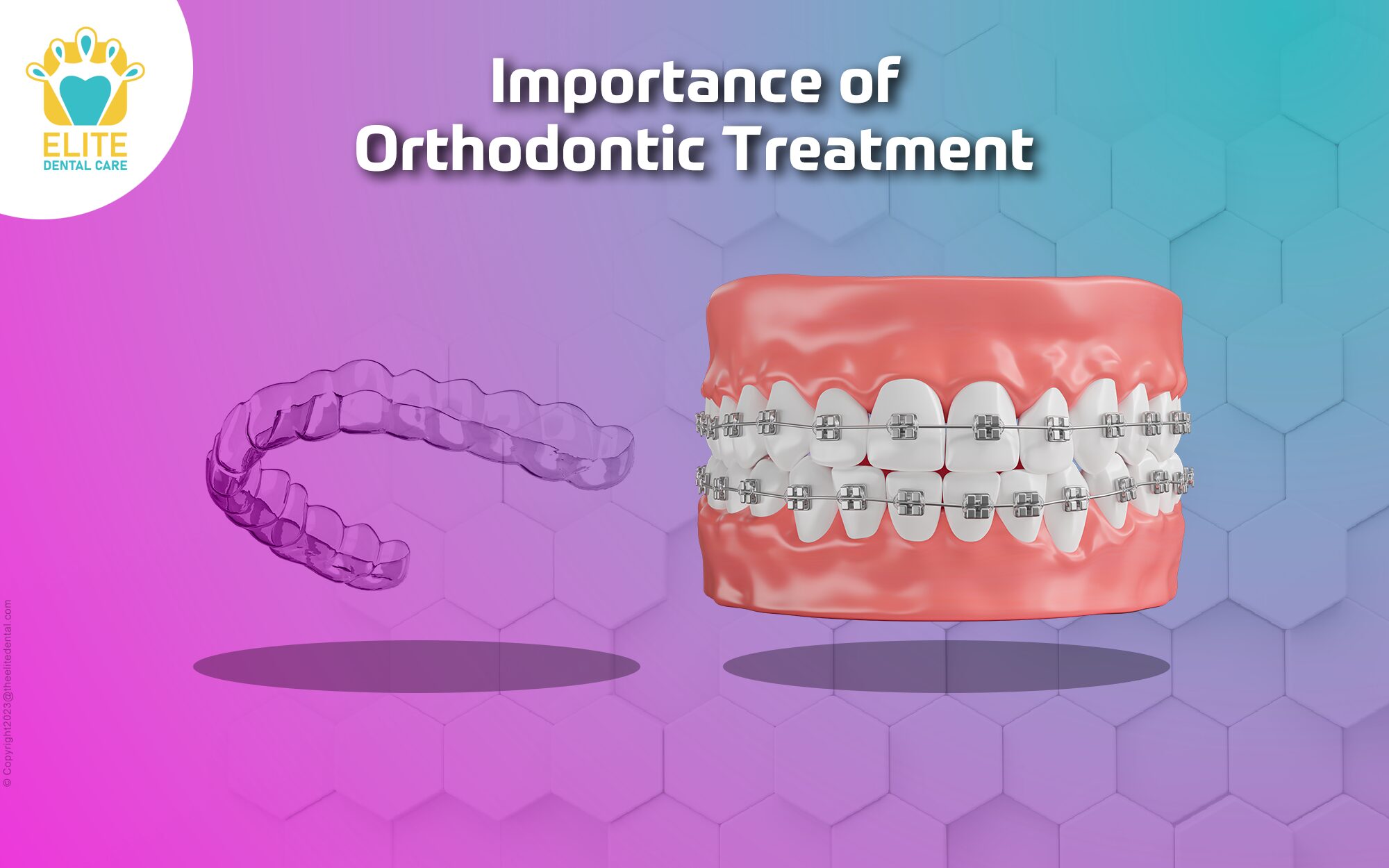 IMPORTANCE OF ORTHODONTIC TREATMENT