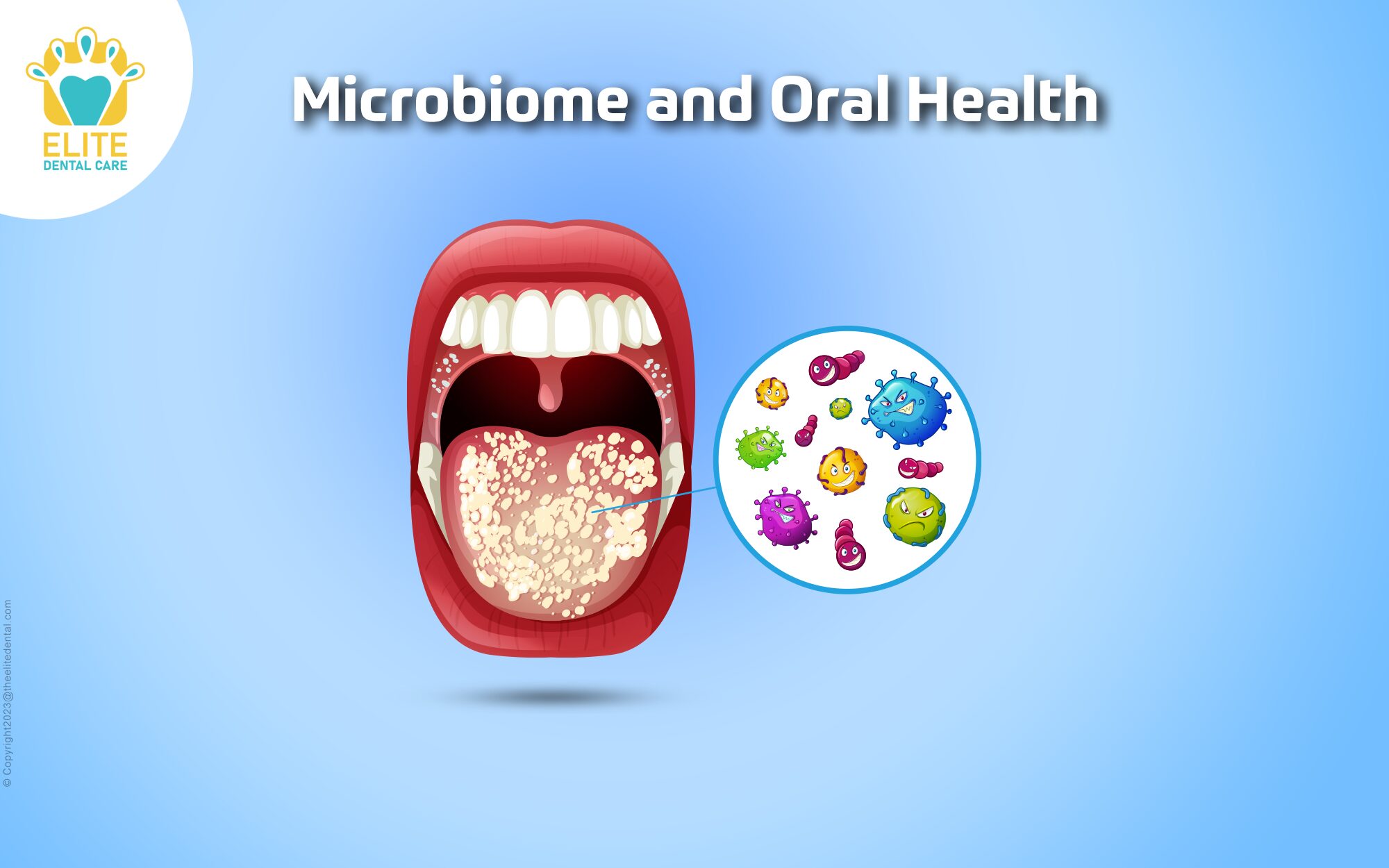 Microbiome and Oral Health