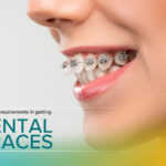 The Usual Requirements in Getting Dental Braces