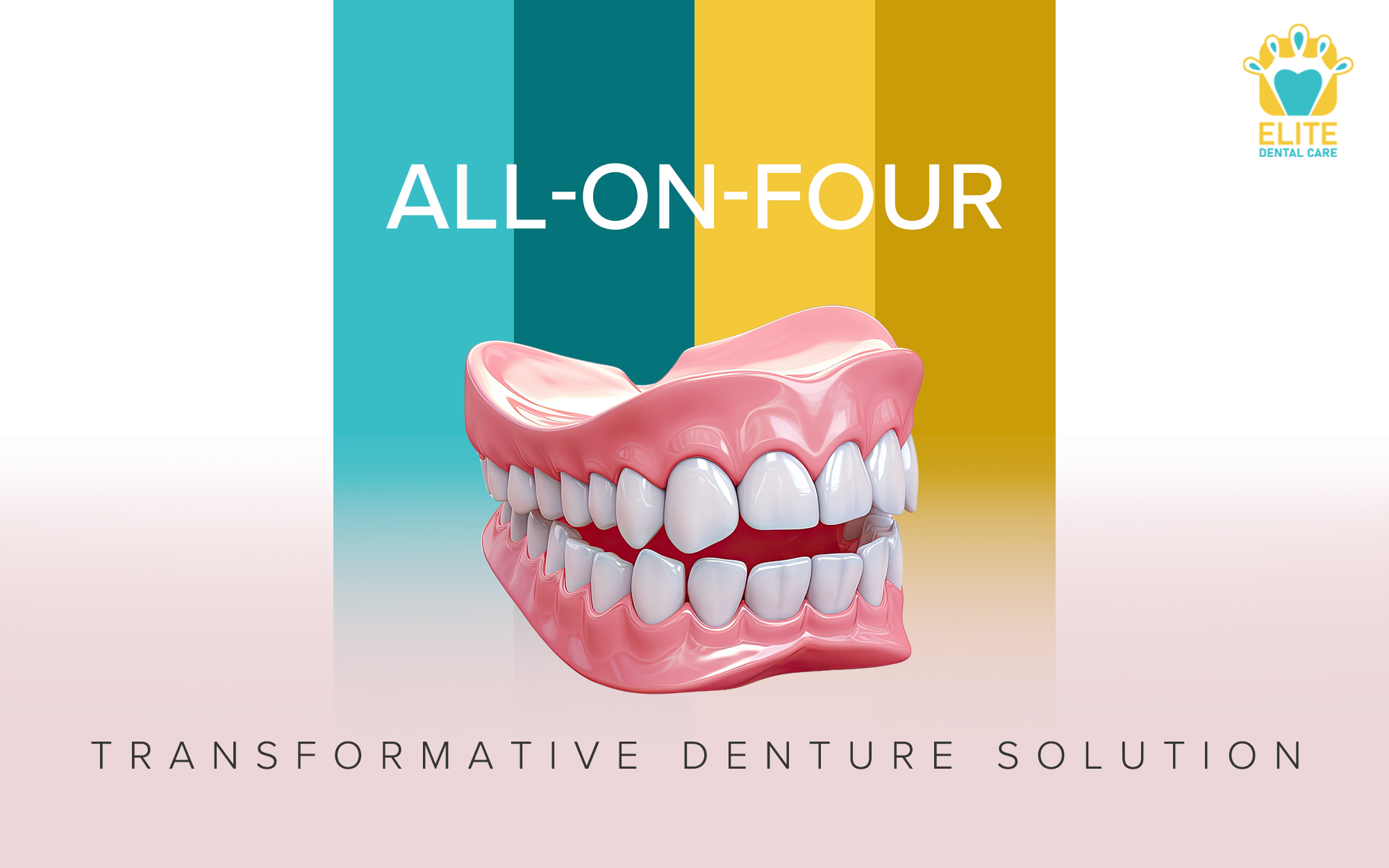 All-On-Four: Transformative Denture Solution