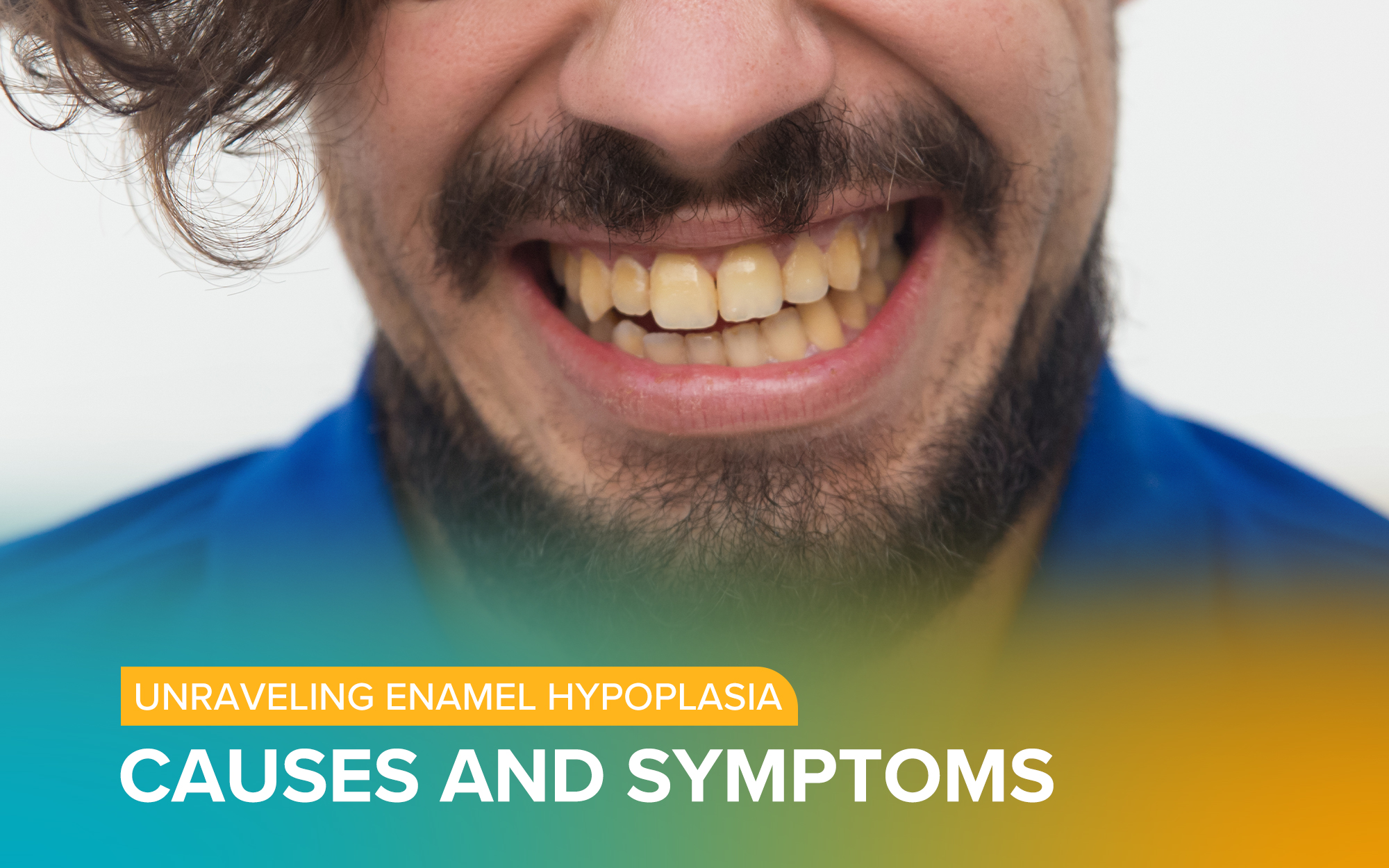 Unravelling Enamel Hypoplasia: Causes and Symptoms