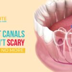 HOW PAINFUL IS A ROOT CANAL PROCEDURE?