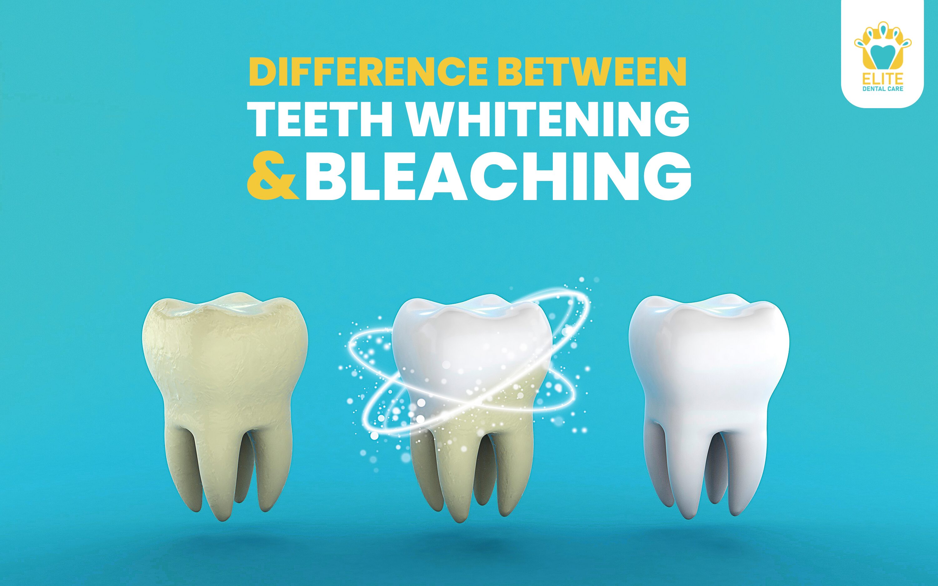 Difference Between Teeth Whitening and Bleaching