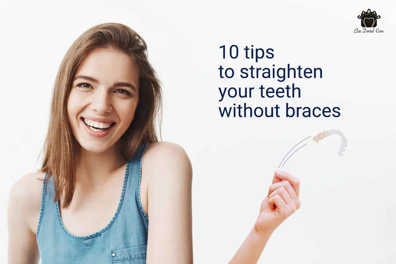 Top Ten Tips to Straighten Your Teeth Without Braces – Elite Dental Care Tracy