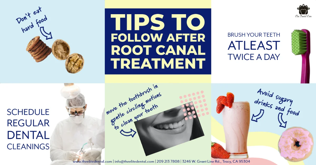 TIPS TO FOLLOW AFTER THE ROOT CANAL TREATMENT- THE ELITE DENTAL CARE TRACY