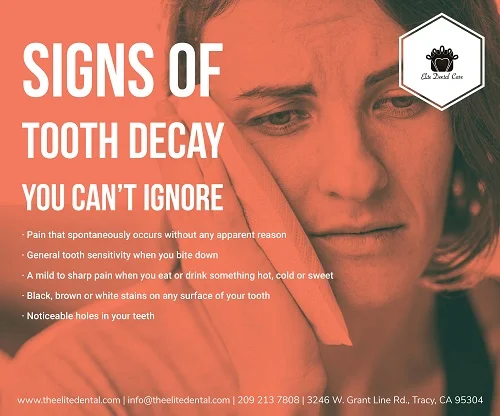 SIGNS OF TOOTH DECAY YOU CANNOT IGNORE – Elite Dental Care