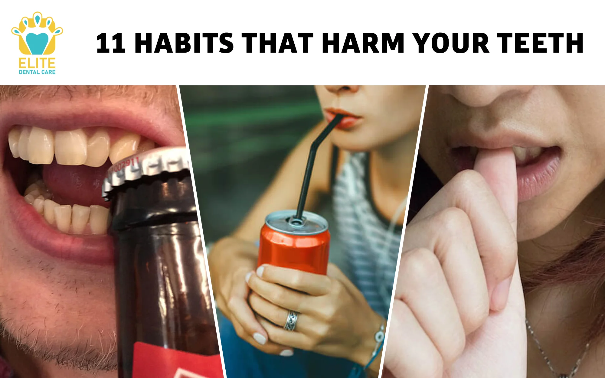 11 HABITS THAT HARM YOUR TEETH – ELITE DENTAL CARE