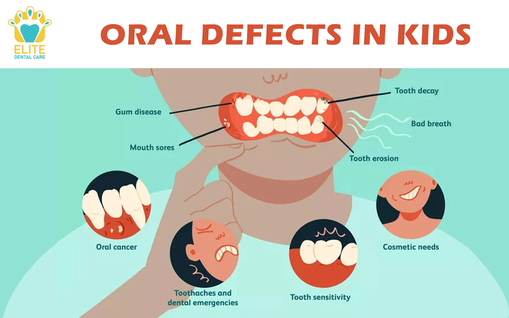 ORAL DEFECTS IN CHILDREN – ELITE DENTAL CARE TRACY