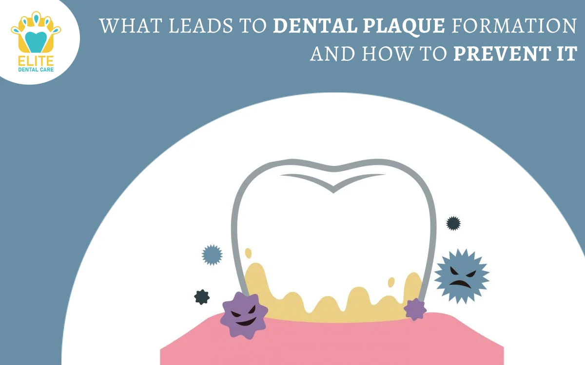 WHAT LEADS TO DENTAL PLAQUE FORMATION & HOW TO PREVENT IT? – ELITE DENTAL CARE