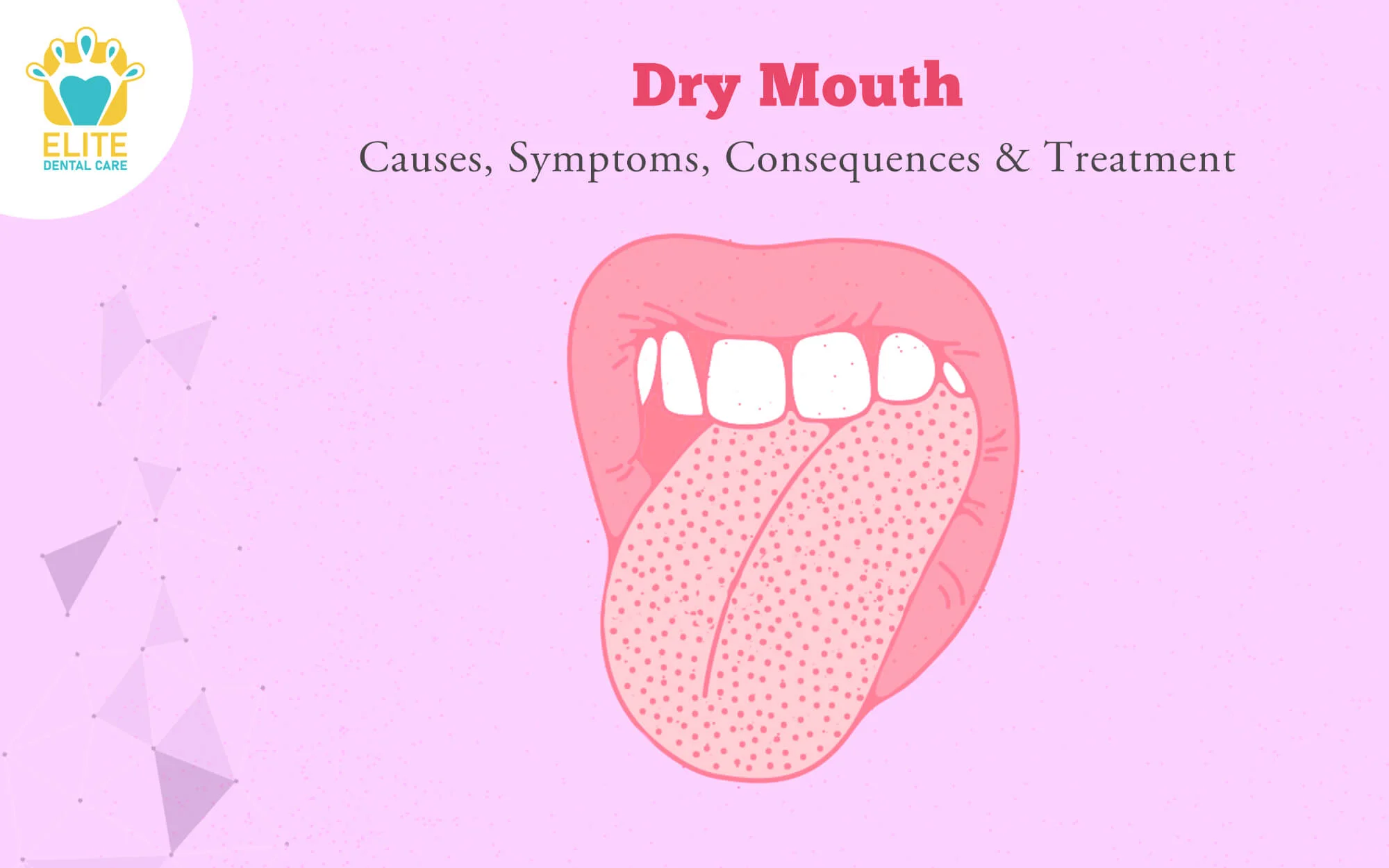 DRY MOUTH: CAUSES, SYMPTOMS, CONSEQUENCES & TREATMENT