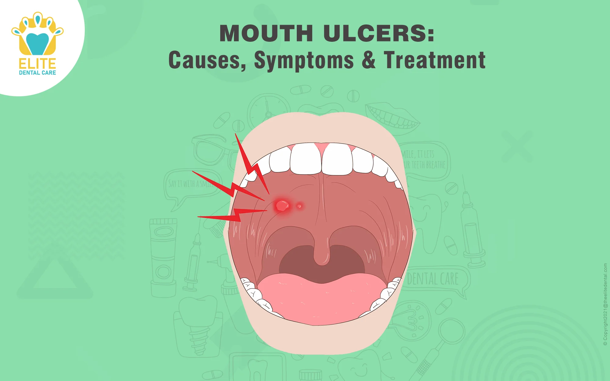 MOUTH ULCERS