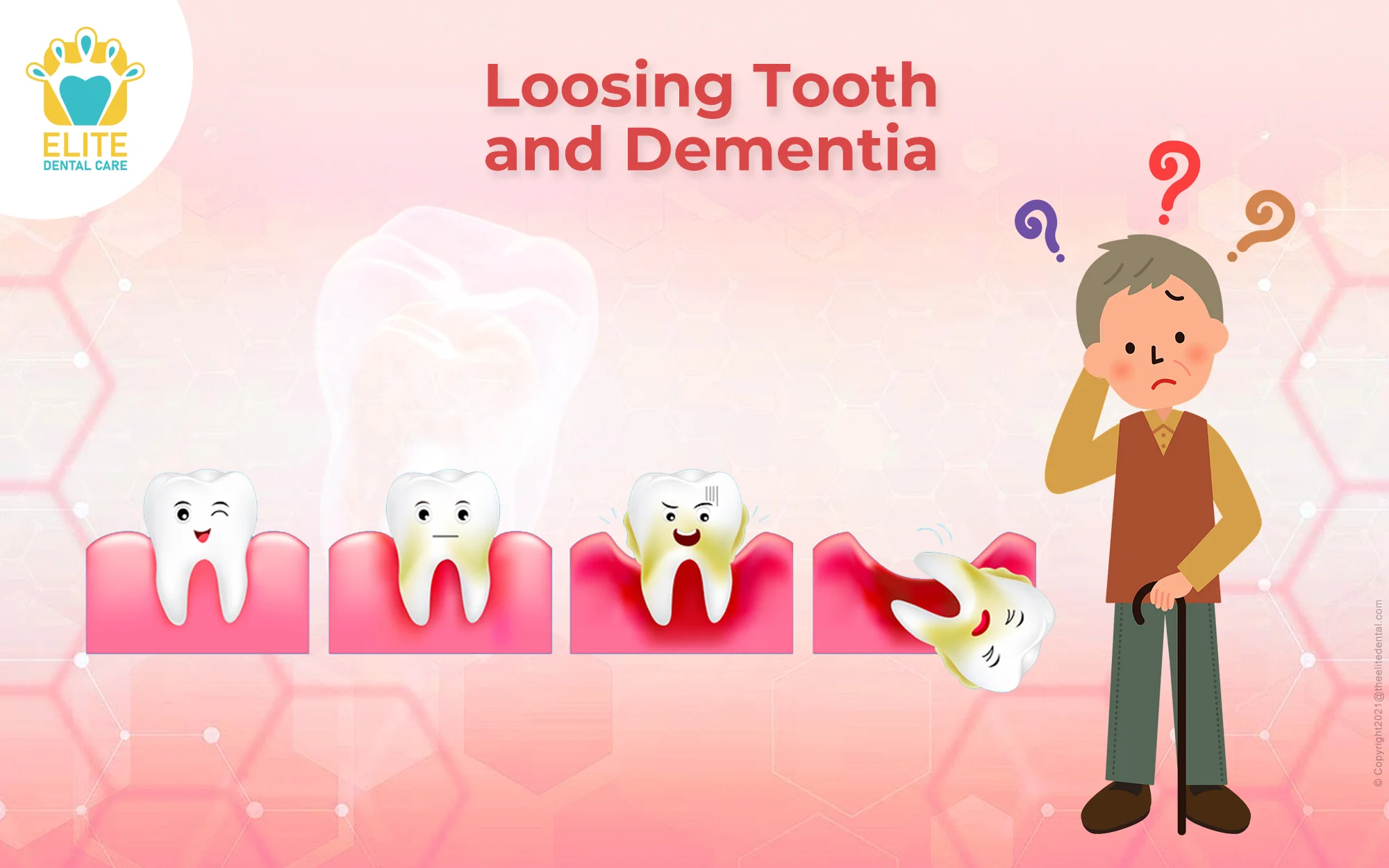 How does Losing Tooth relate to Dementia?