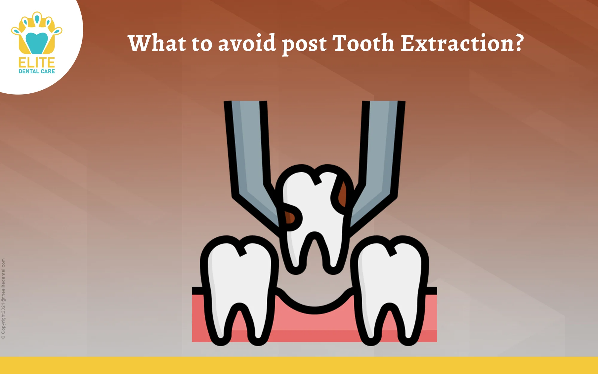 What to avoid after tooth extraction?