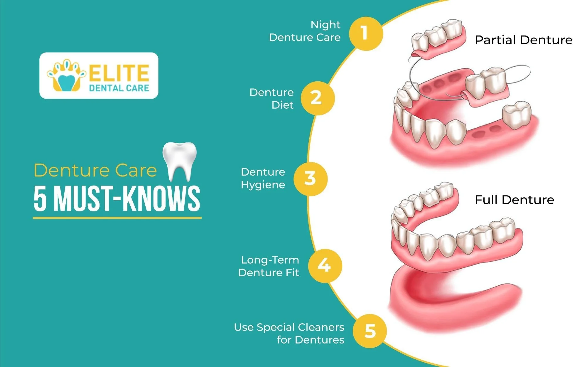 5 THINGS YOU SHOULD KNOW IF YOU HAVE DENTURES